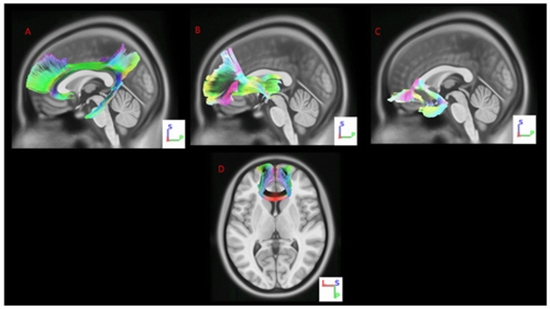 Antidepressant effects of magnetic resonance imaging—based {faces}